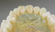 テスト歯科技工士CS24-01